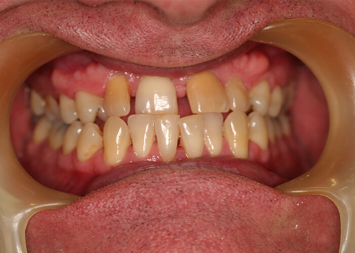 Smile Gallery - Portmore Dental